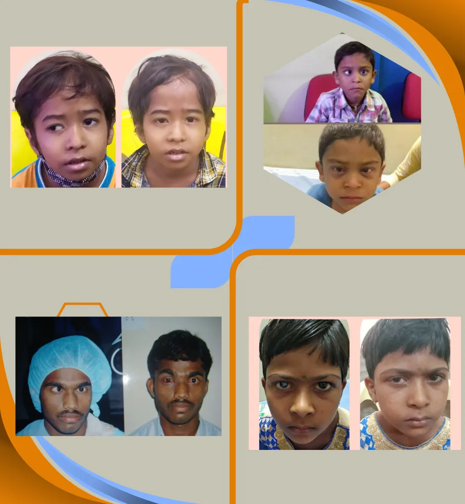 Paediatric-Ophthalmology